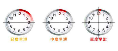 早泄