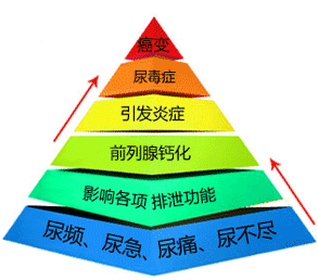 前列腺炎